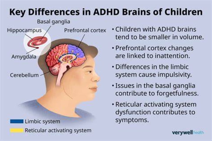 What happens in the brain with ADD?