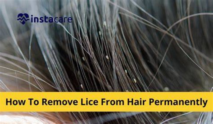 What happens when you don't treat lice?