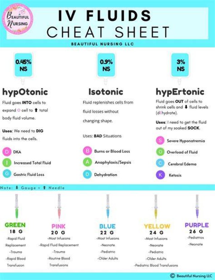 What is a good IV for options?