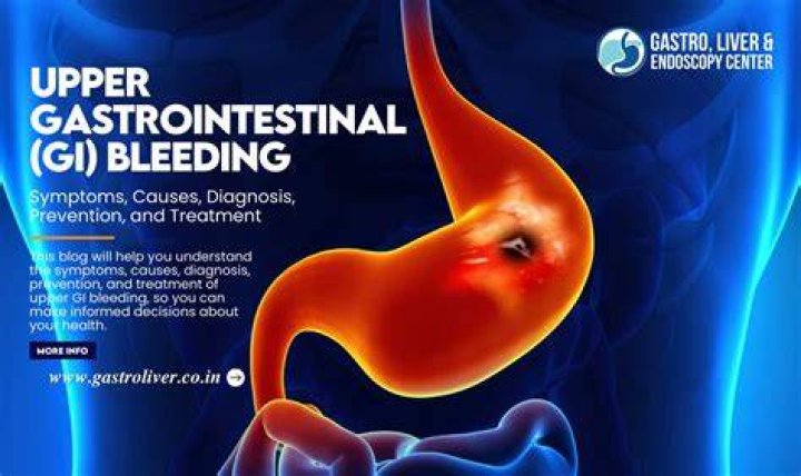 What is a massive GI bleed?