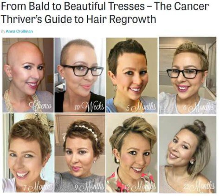What is hair like after chemo?