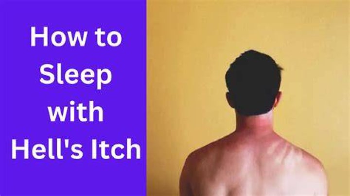 What is Hell's itch?