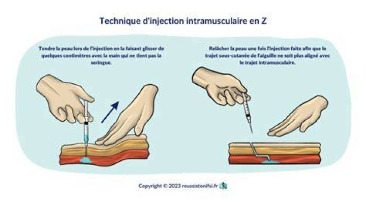 What is La injection?