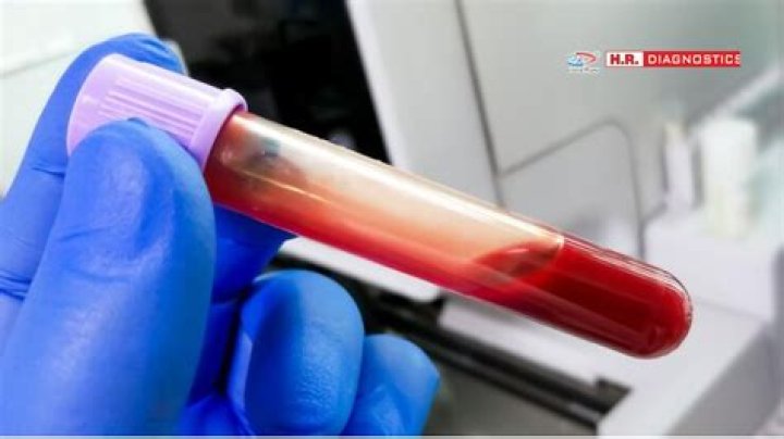 What is PLM in blood test?
