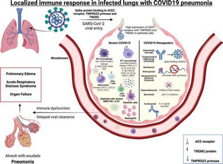 What is severe Covid pneumonia?