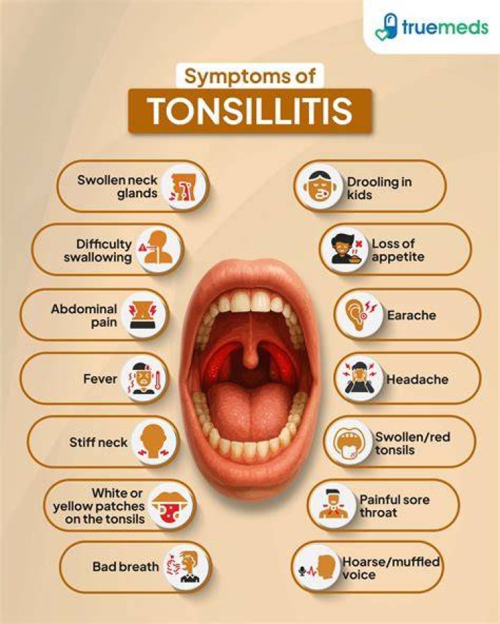 What is symptoms of tonsil infection?