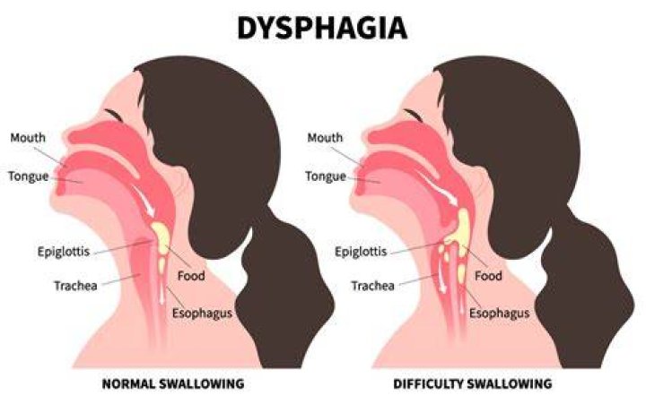 What is the best drink for dysphagia?