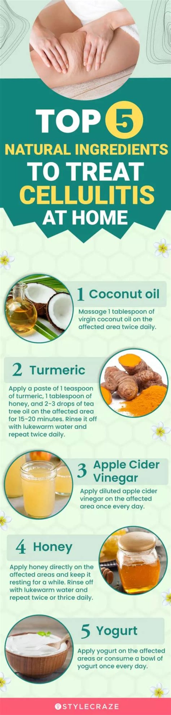 What is the best home remedy for cellulitis?