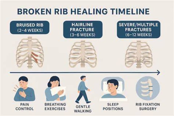 What is the best painkiller for broken ribs?