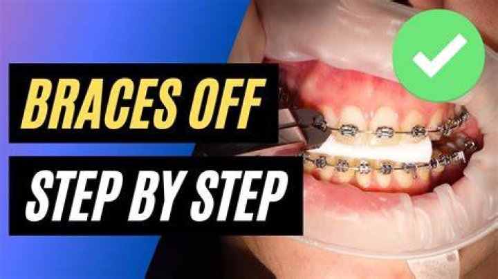 What is the last step before braces come off?