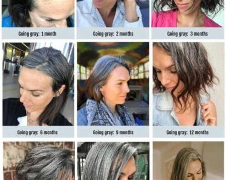 What is the normal age to get GREY hair?
