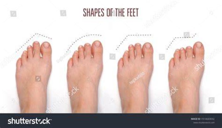 What is the perfect foot shape?
