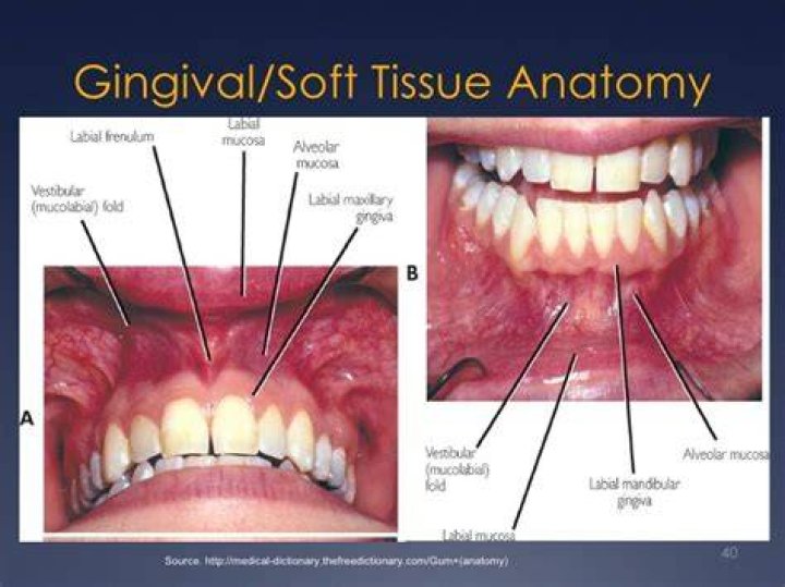 What is the skin between your gums and lip called?