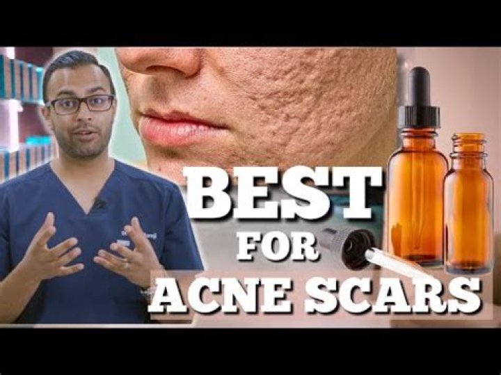 What natural ingredient removes scars?