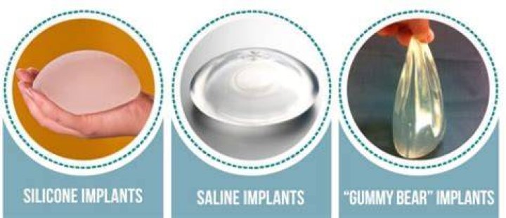 What no one tells you about breast implants?