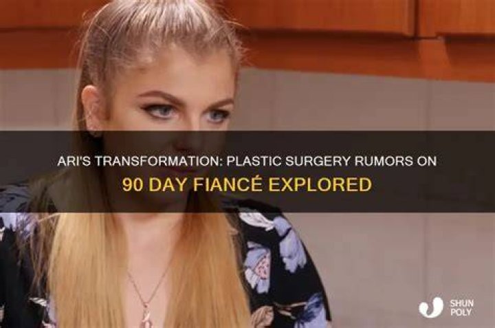 What plastic surgery did Ari have?