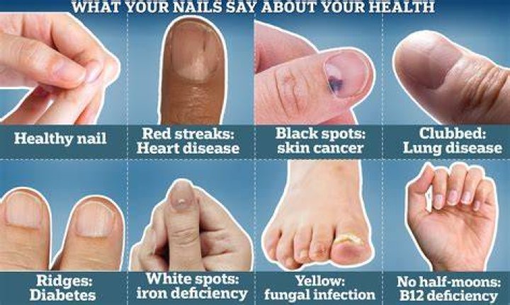 What poison turns your fingernails black?