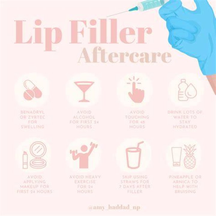 What should I not do after lip fillers?