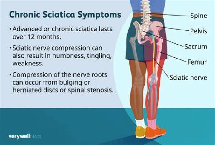 What should I not do with sciatica?