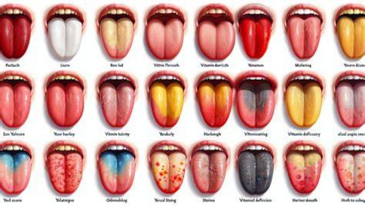 What should my tongue look like?