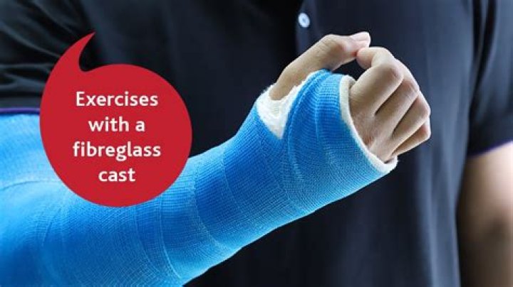 What to avoid while wearing a cast?