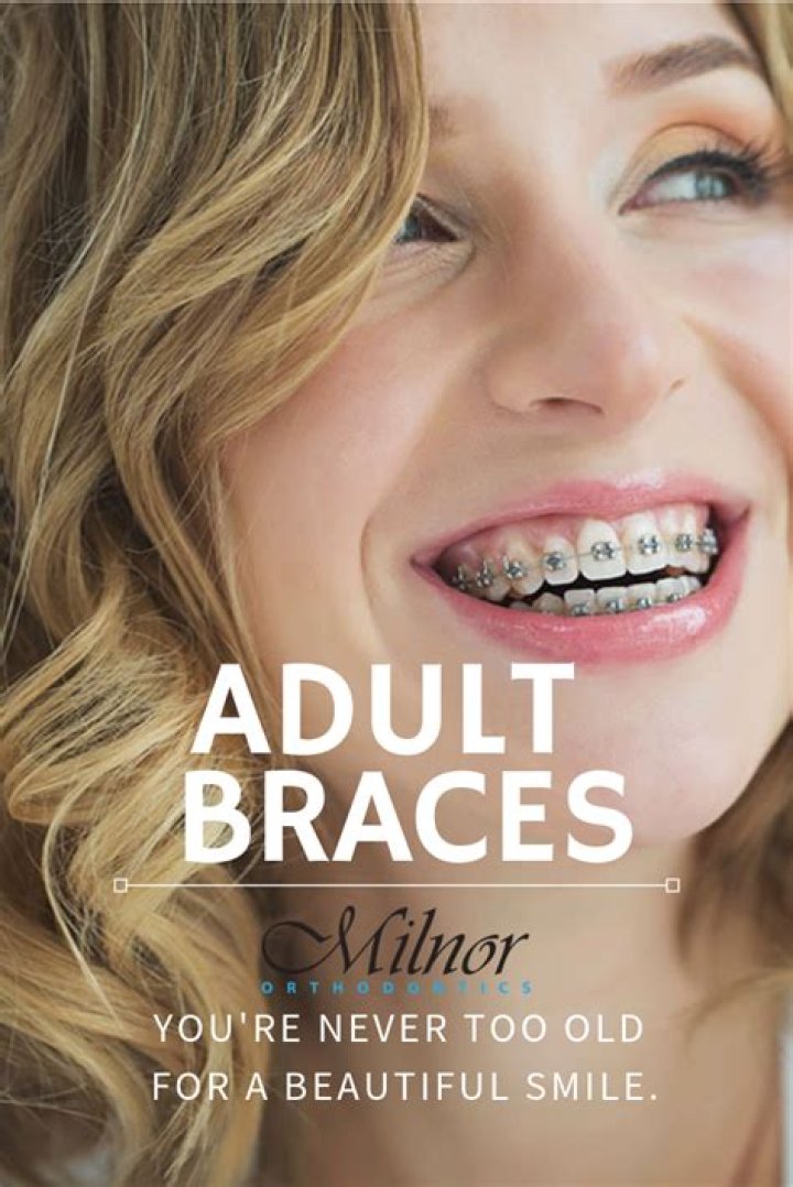 When are you too old to have braces?