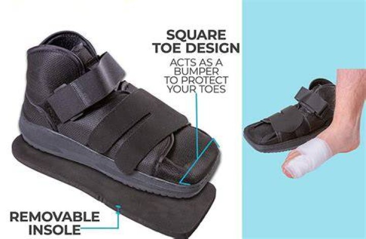 When can I wear regular shoes after bunion surgery?