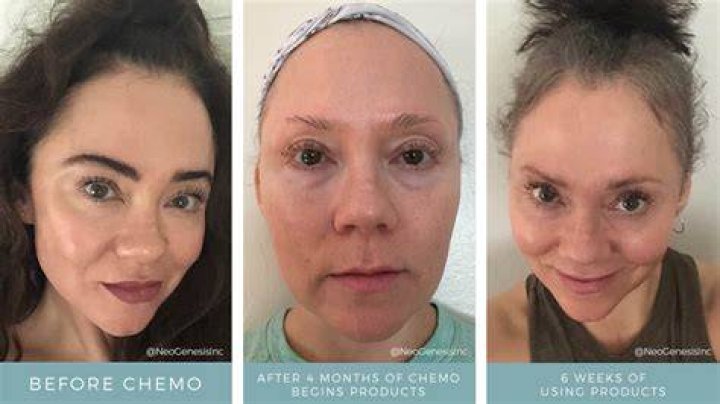 When do you lose eyebrows during chemo?