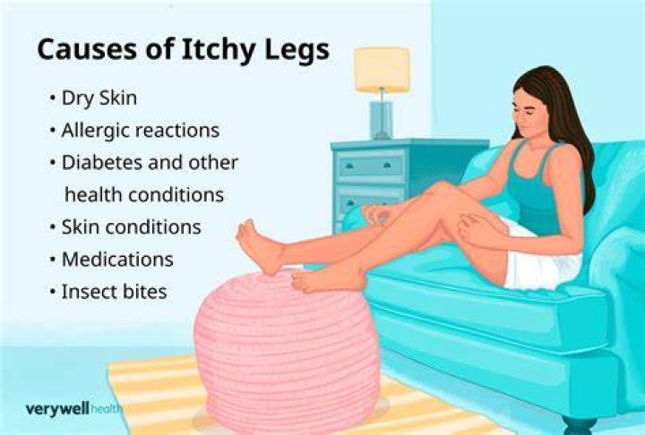 When should I be concerned about itchy legs?