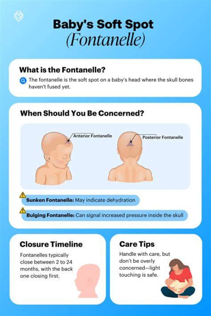 When should I be worried about a bulging soft spot?