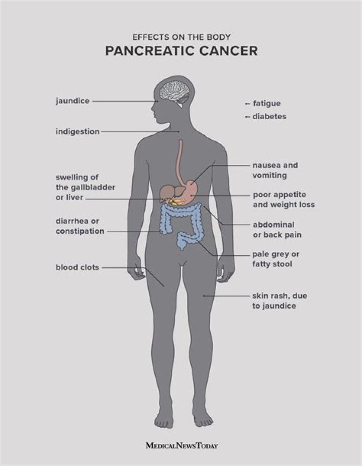 Where is pancreatic back pain located?