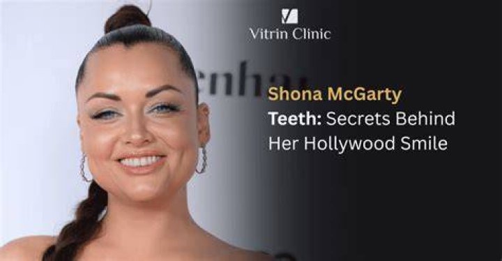 Which actress has artificial teeth?