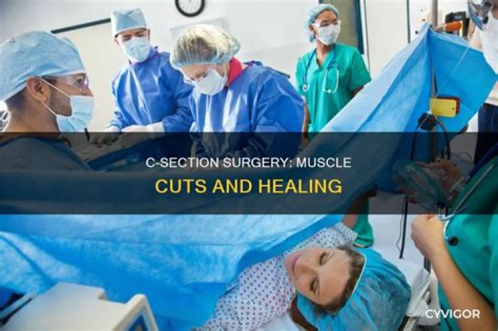 Which C-section cut is better?