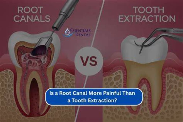 Which is more painful tooth extraction or root canal?