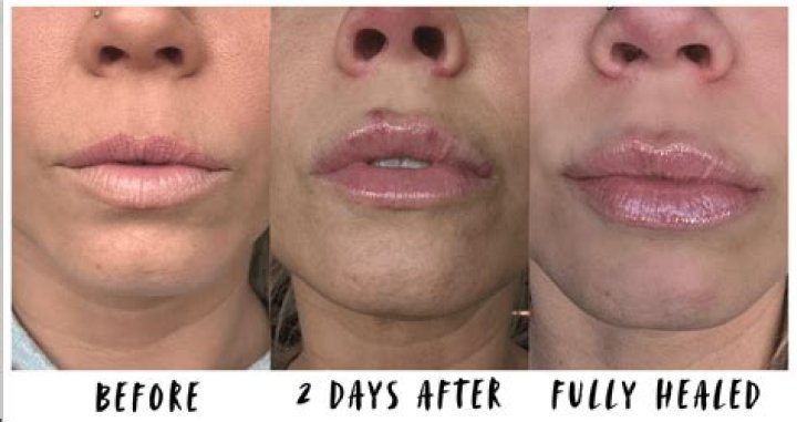 Who does Lip end up with?