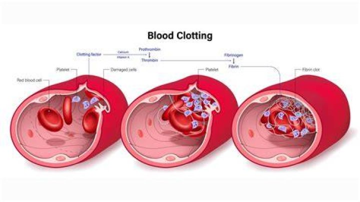 Who is prone to clotting?