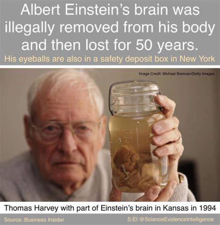 Who took Alberts brain?