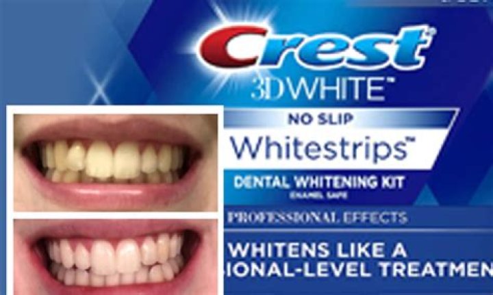 Why are Crest White Strips not working?