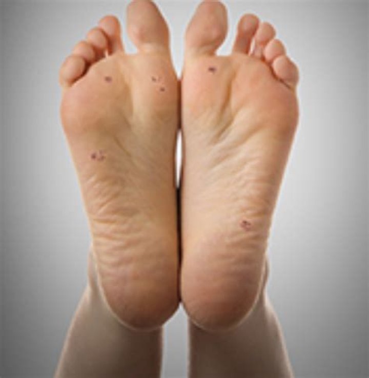 Why are my feet black at the bottom?