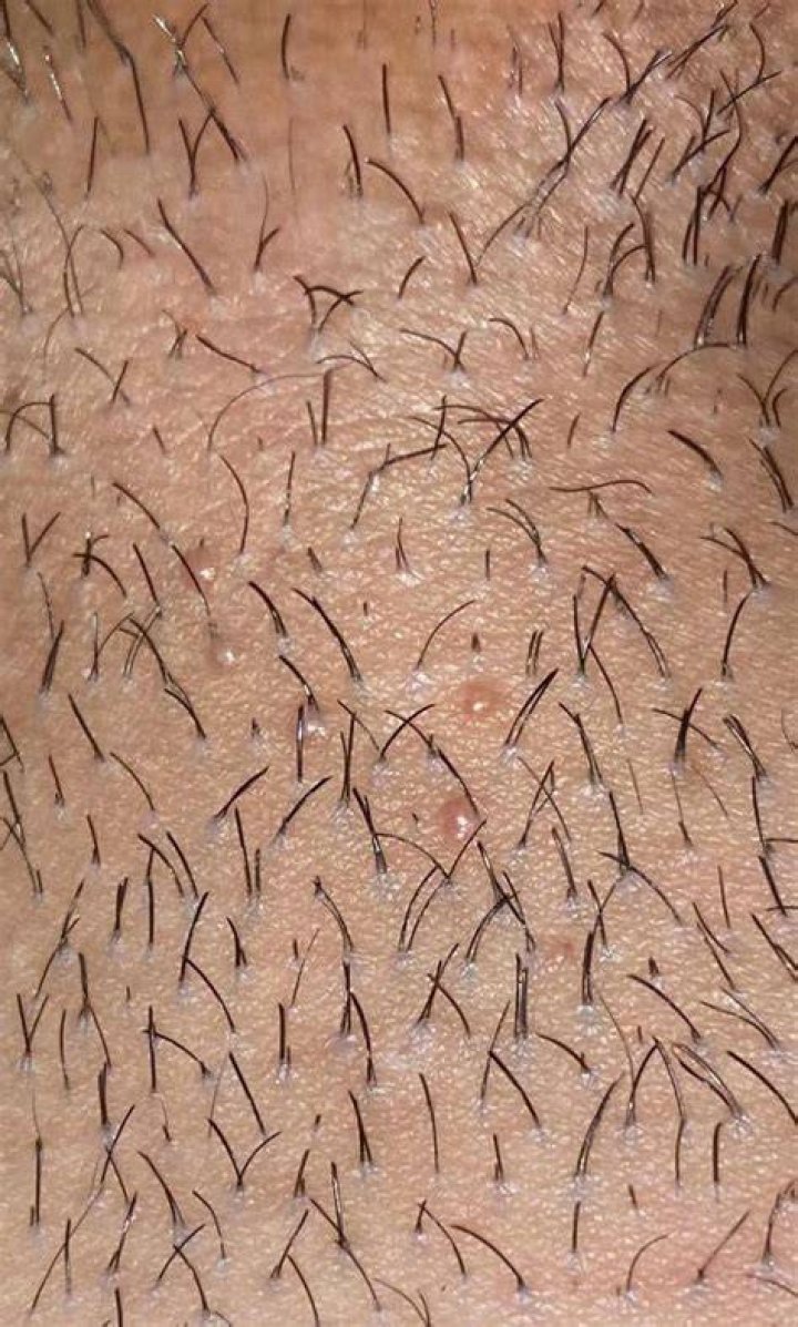 Why are my pubes turning orange?