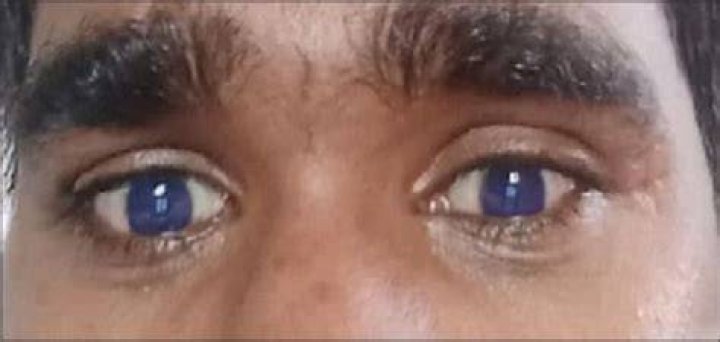 Why did Derek's eyes turn from blue to yellow?