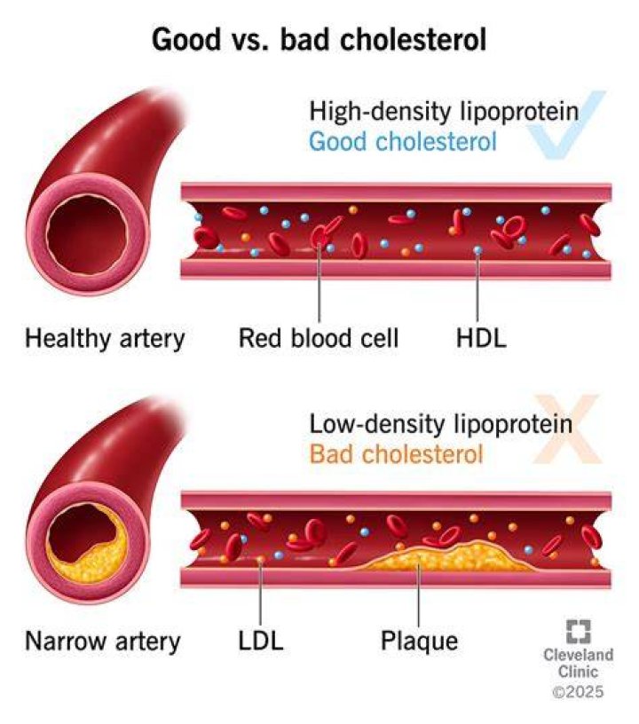 Why did my cholesterol go down but triglycerides go up?