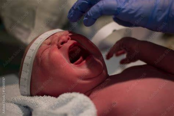 Why do doctors hit babies when they are born?