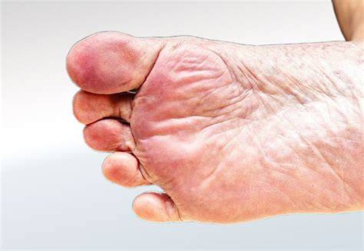 Why do doctors look at the bottom of your feet?