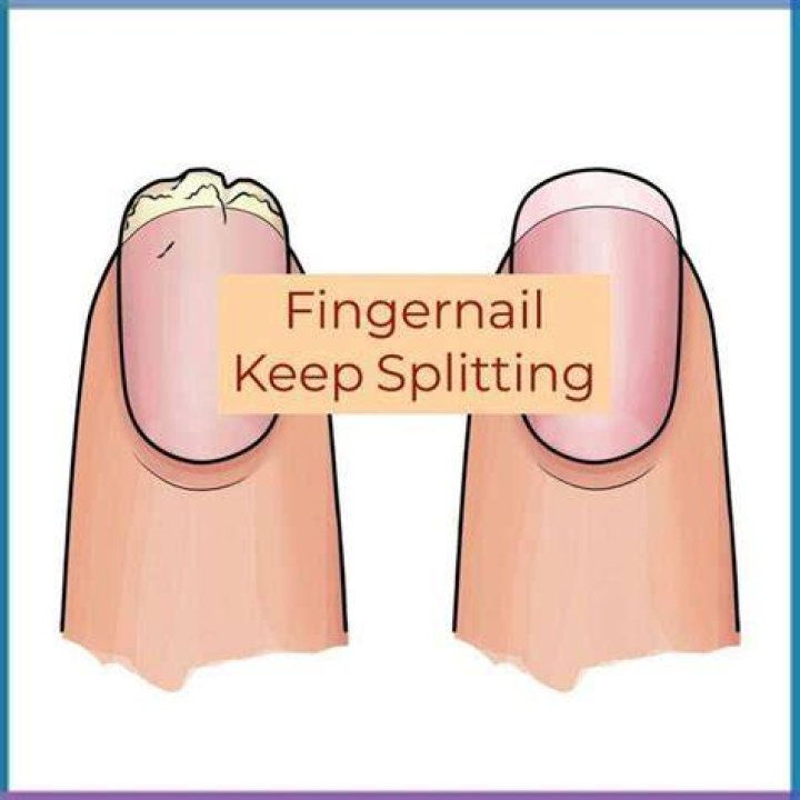 Why do fingernails split lengthwise?