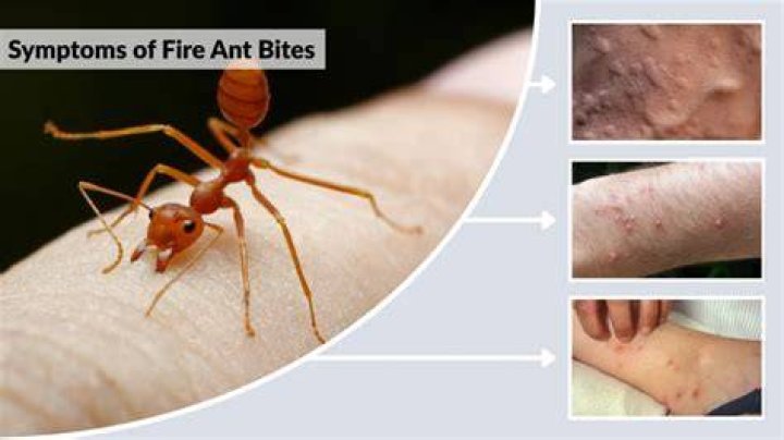 Why do fire ant bites filled with pus?