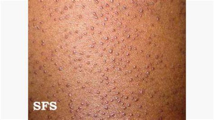 Why do I get black dots when I fake tan?