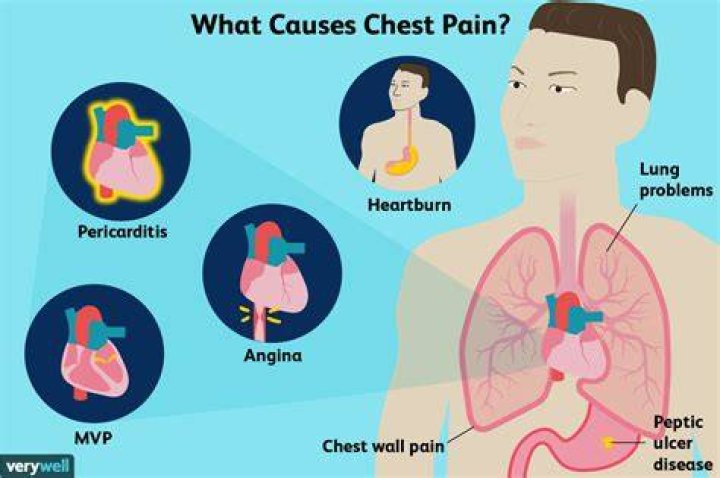Why do I have chest pain after COVID?