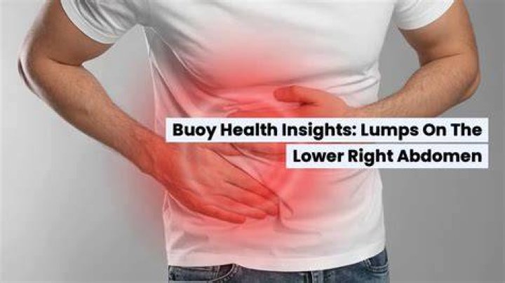 Why do I have lumps in my abdomen?