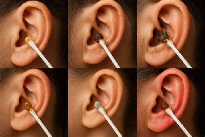 Why do I have so much earwax in the morning?